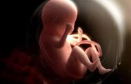 هل يجوز إجهاض الجنين المشوه بناءً على طلب الطبيب؟