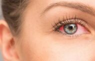نصائح لمنع التهابات العيون والحساسية الموسمية