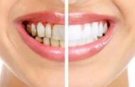 علاجات طبيعية لإزالة تراكم الجير من الأسنان