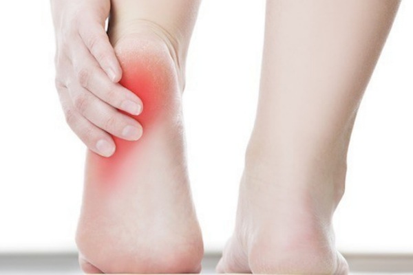 طرق طبيعية لتخفيف آلام القدم: وصفات فعّالة